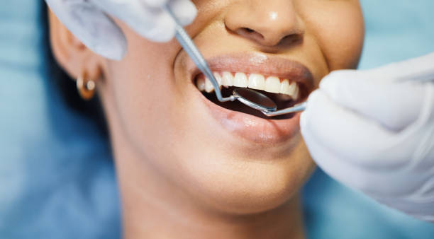 Best Mobile Emergency Dentist in Littlerock, CA