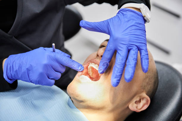 Best Broken or Cracked Tooth Emergency Dentist in Littlerock, CA