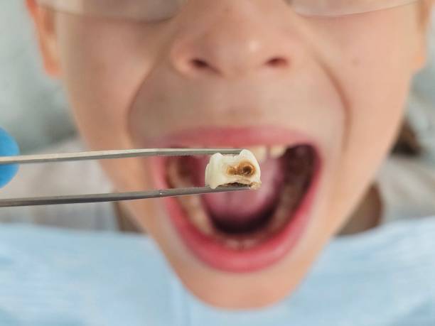 Best Emergency Dental Services for Seniors in Littlerock, CA
